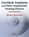 Cochlear implants and other implantable hearing devices