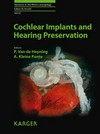 Cochlear implants and hearing preservation